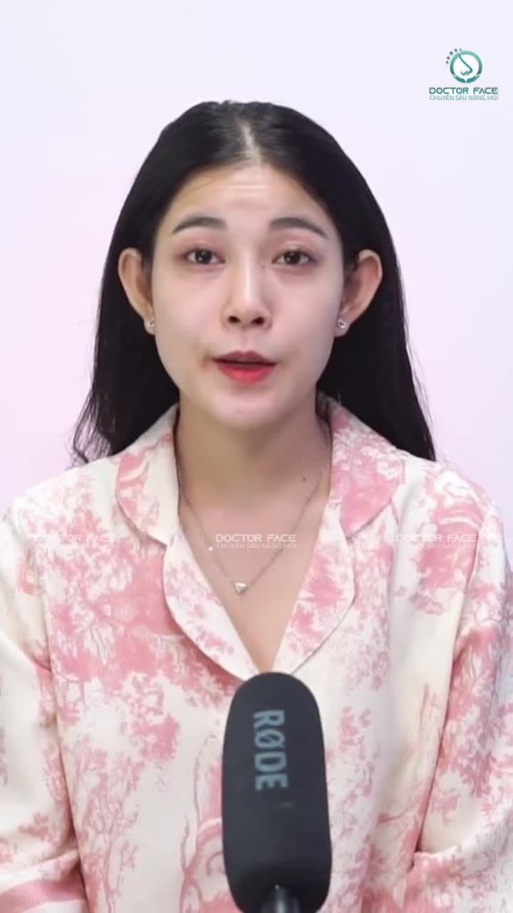 Từng cấy chỉ mũi rồi quyết định nâng mũi, sau hơn 5 tháng bạn ấy có những cảm nhận như thế nào về lựa chọn này?