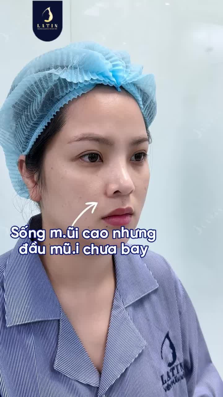 DIỆN MẠO HOÀN MỸ BẮT ĐẦU TỪ TÁI CẤU TRÚC MŨI