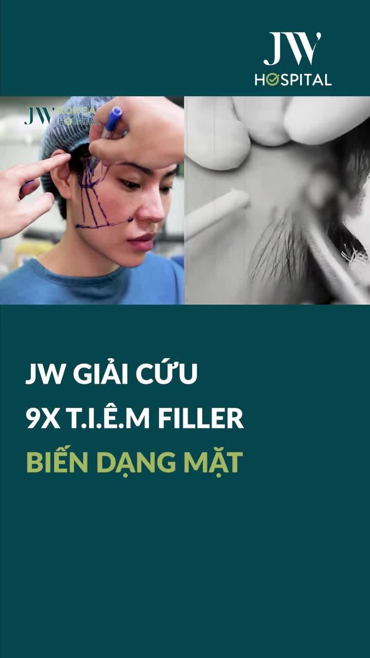 BÁC SĨ JW GIẢI CỨU NGƯỜI PHỤ NỮ TP.HCM KHỎI THÁI DƯƠNG BIẾN DẠNG SAU 4 NĂM TIÊM FILLER
