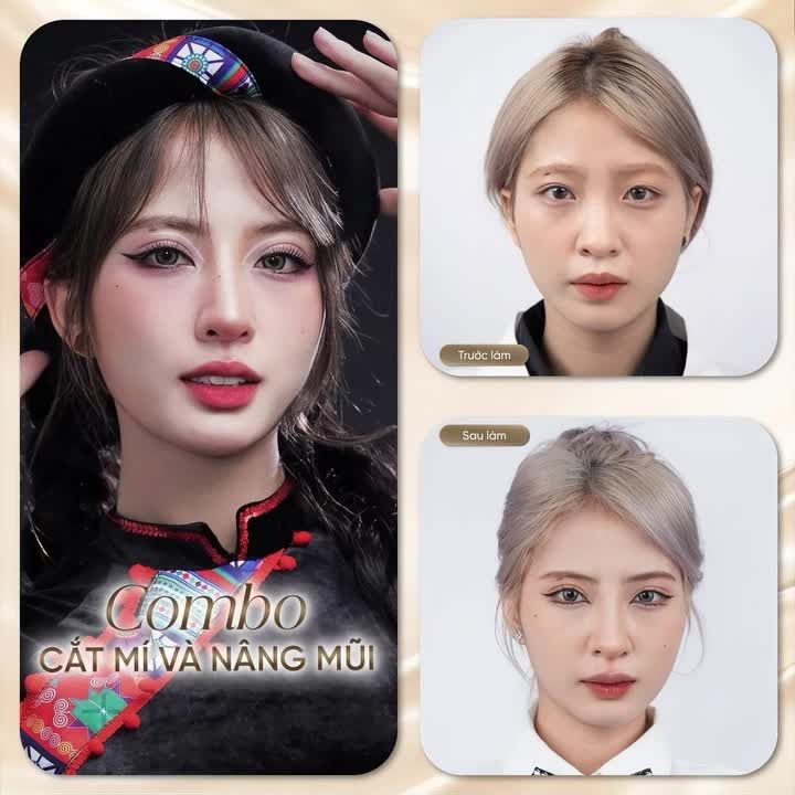 Tổng hợp combo Mũi - Mí siêu "cuốn" tại Tấm!