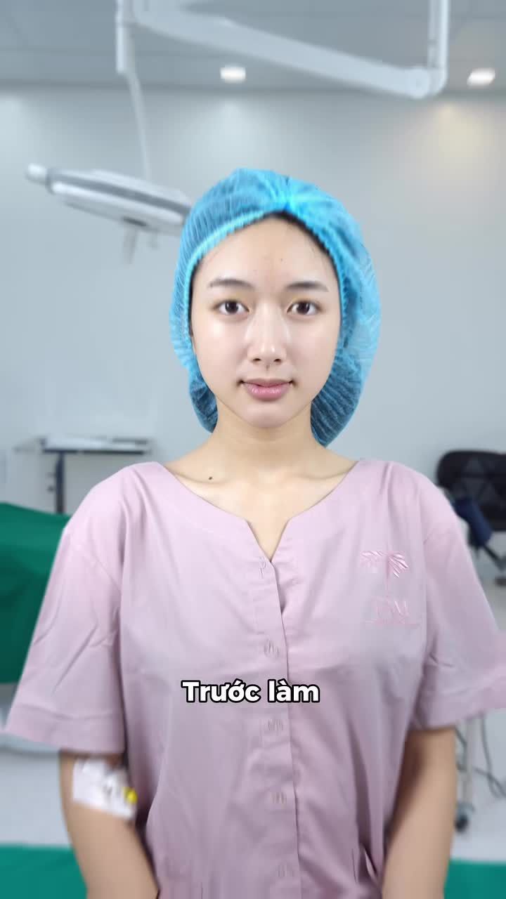 Cùng Tấm "tái sinh" đôi mắt với công nghệ cắt mí Shanghai. Cho nếp mí đều đẹp, nhẹ nhàng không đau