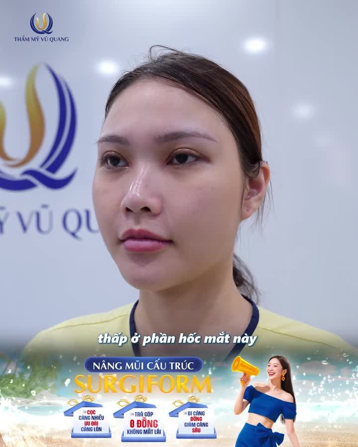 Sụn Surgiform vốn được mệnh danh là dòng "sụn quốc dân" được lòng rất nhiều chị em, và cô bạn trong hình cũng không ngoại lệ.