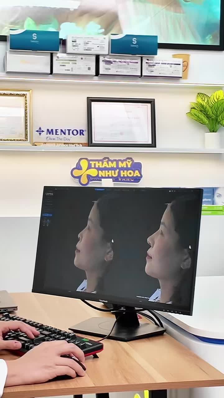 Điều nhiều người sợ nhất trước khi nâng mũi không phải là thay đổi, mà là không biết sau thay đổi mình sẽ trông như thế nào.