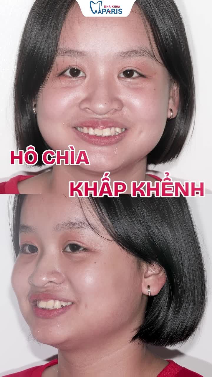 24 THÁNG HẾT HÔ CHÌA – LỘT XÁC NỤ CƯỜI TỰ TIN