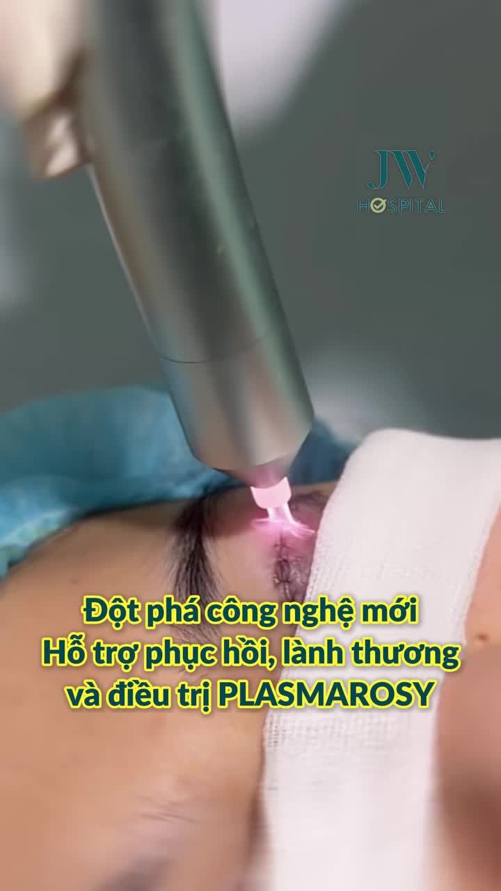 LÀM ĐẸP KHÔNG ĐAU, KHÔNG SƯNG, KHÔNG SẸO VỚI PLASMAROSY