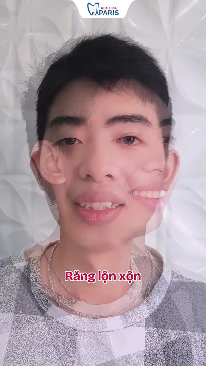 NIỀNG RĂNG TRONG SUỐT INVISALIGN – TỰ TIN GIAO TIẾP MỖI NGÀY