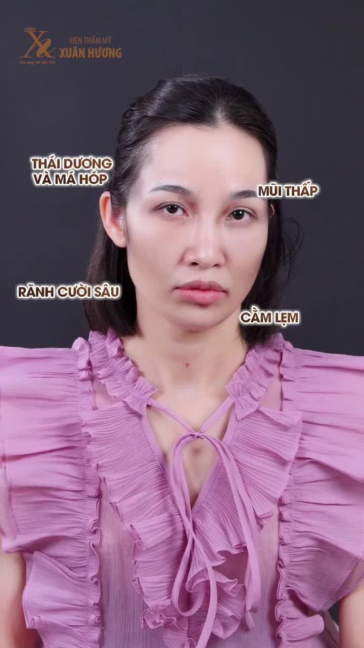 KHUÔN MẶT HỐC HÁC, THIẾU SỨC SỐNG?