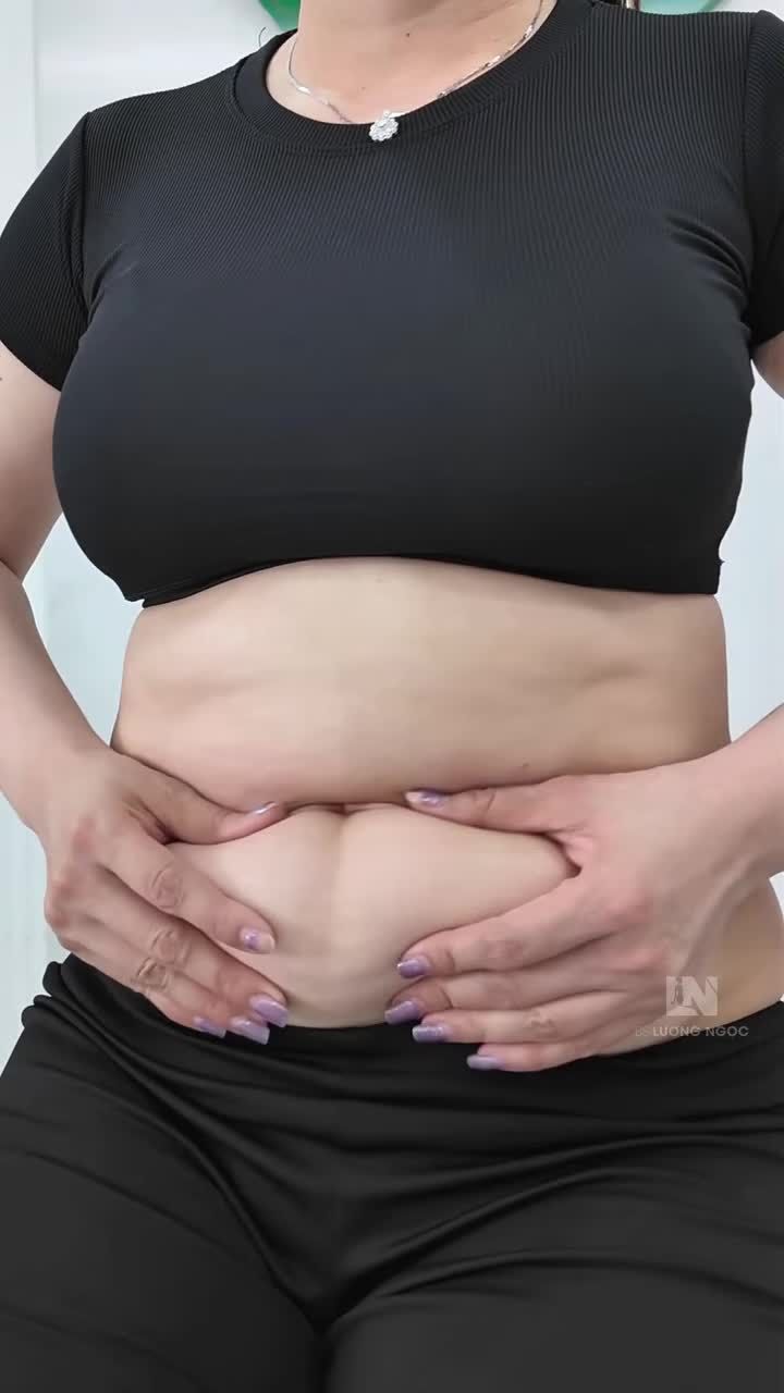 Hút mỡ co da và cái kết vượt ngoài mong đợi
