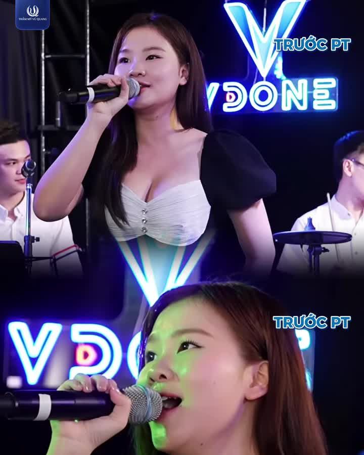 45 PHÚT THAY ĐỔI - MŨI ĐẸP TRỌN ĐỜI