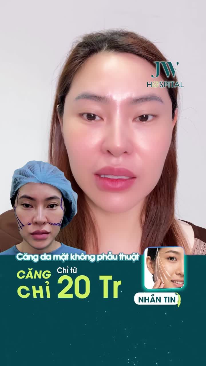 TRẺ 20 TUỔI KHÔNG PHẪU THUẬT CHO CHỊ GÁI 9X VỚI CĂNG CHỈ MESH LIFT SẸO VÔ HÌNH