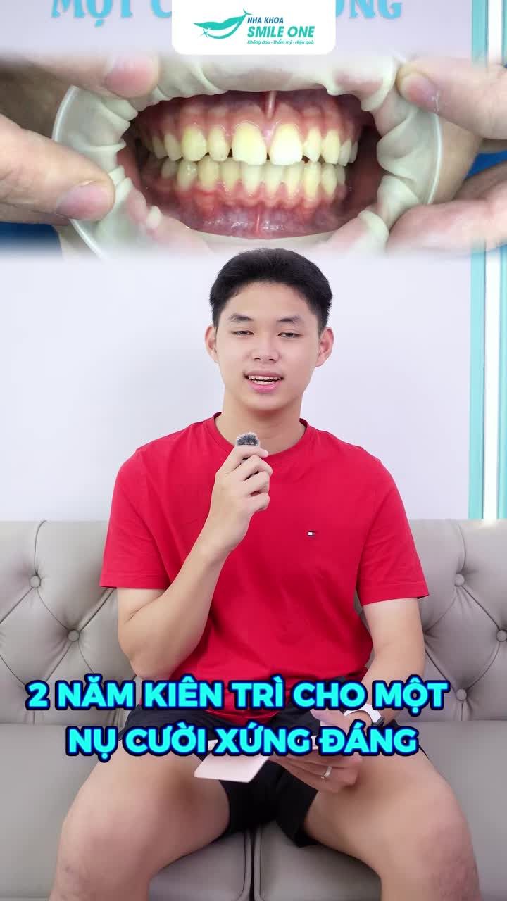 MẺ RĂNG KHI CHƠI THỂ THAO, VÀ ĐÂY LÀ KẾT QUẢ SAU HÀNH TRÌNH NIỀNG RĂNG