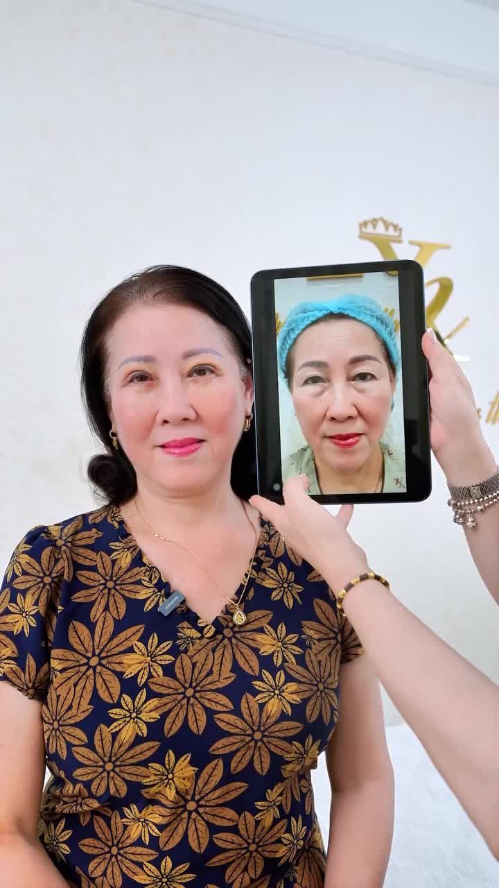 CHỦ TỊCH XUÂN HƯƠNG LẮNG NGHE CHIA SẺ CỦA KHÁCH HÀNG THỰC HIỆN COMBO CẮT MÍ TRÊN DƯỚI