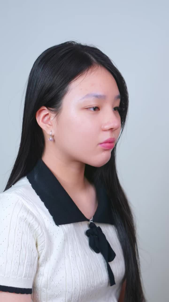 TÁI KHÁM HẬU PHẪU 15 NGÀY: "LỘT XÁC" NGOẠN MỤC 180 ĐỘ NHỜ COMBO MẮT - MŨI - CẰM XUẤT SẮC!