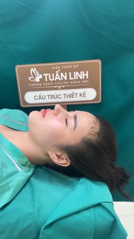 Mũi nâng cấu trúc