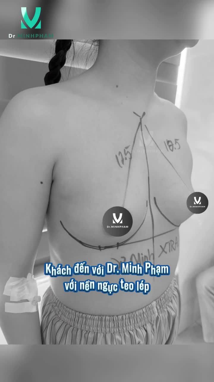 Chị em muốn sở hữu dáng ngực này