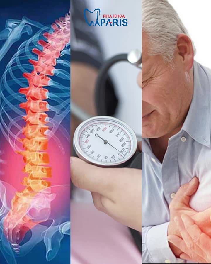 LOÃNG XƯƠNG, HUYẾT ÁP, TIM MẠCH,...THÌ KHÔNG THỂ TRỒNG RĂNG IMPLANT? THỰC TẾ LÀ...