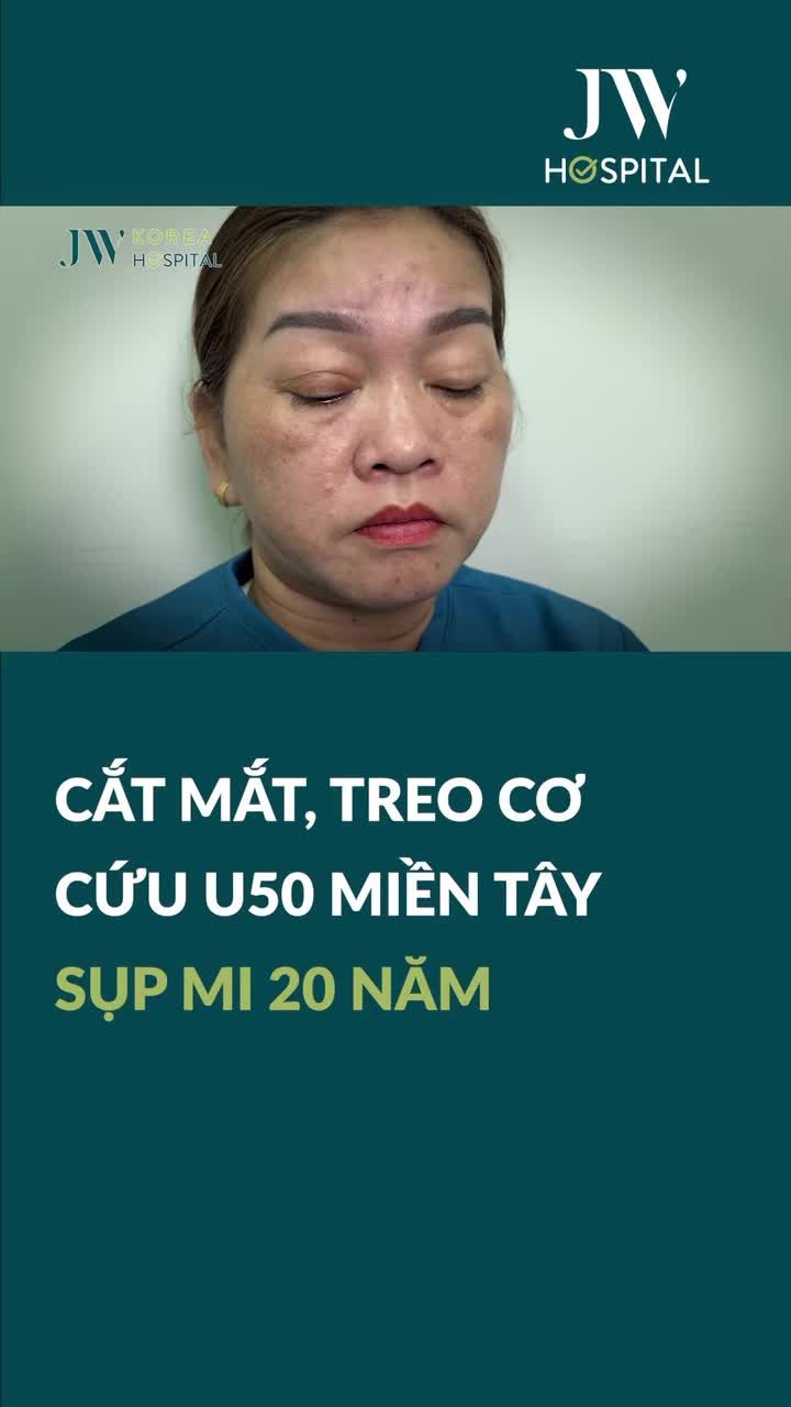 KỲ TÍCH BÁC SĨ TÚ DUNG CẮT MẮT, TREO CƠ TRỊ SỤP MI GIÚP U50 MIỀN TÂY LẦN ĐẦU MỞ MẮT SAU 20 NĂM