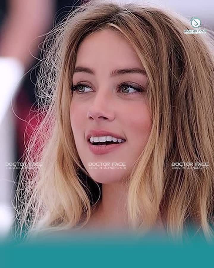 "Muốn dáng mũi cao tây như Amber Heard thì có làm theo y hệt được không?"