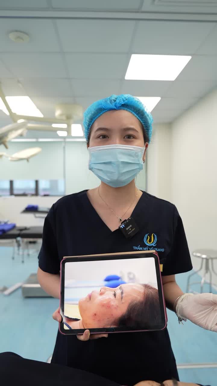 Tin tưởng đưa con đến BS Vũ Quang, người mẹ tâm lí tới từ Quảng Trị cũng đã quyết định sửa lại dáng mũi gắn bó suốt 25 năm. Cùng xem kết quả trong livestream nhé!