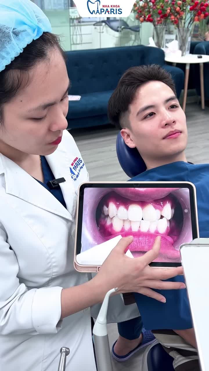 TẠM BIỆT RĂNG KHẤP KHỂNH, LỆCH MẶT SAU HÀNH TRÌNH NIỀNG RĂNG NHẸ NHÀNG