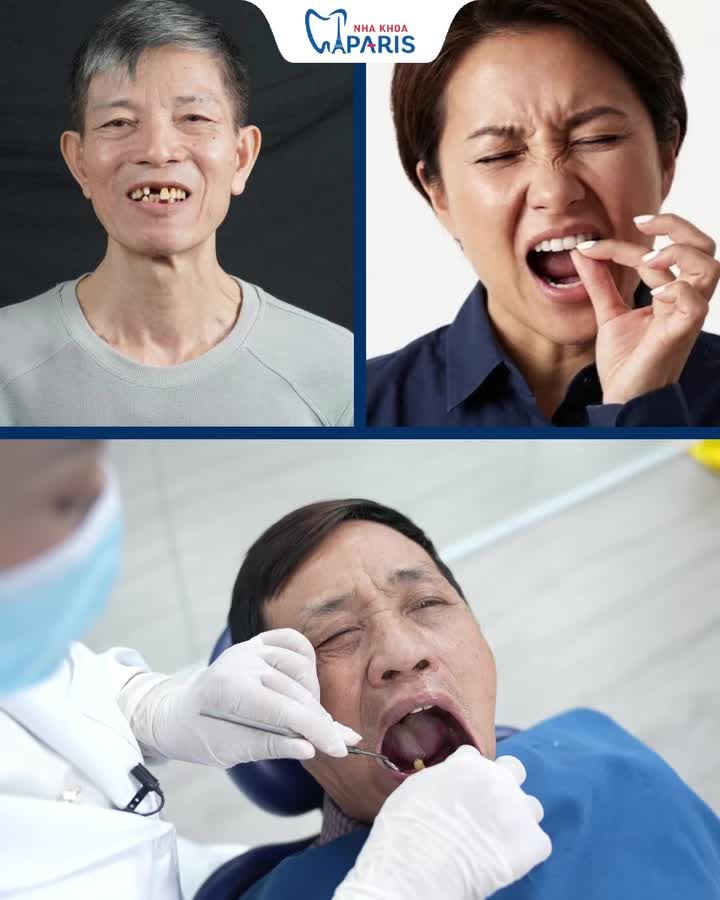 VUI HÈ TRỌN VẸN – ĂN NGON CƯỜI KHỎE VỚI CÔNG NGHỆ IMPLANT 2026