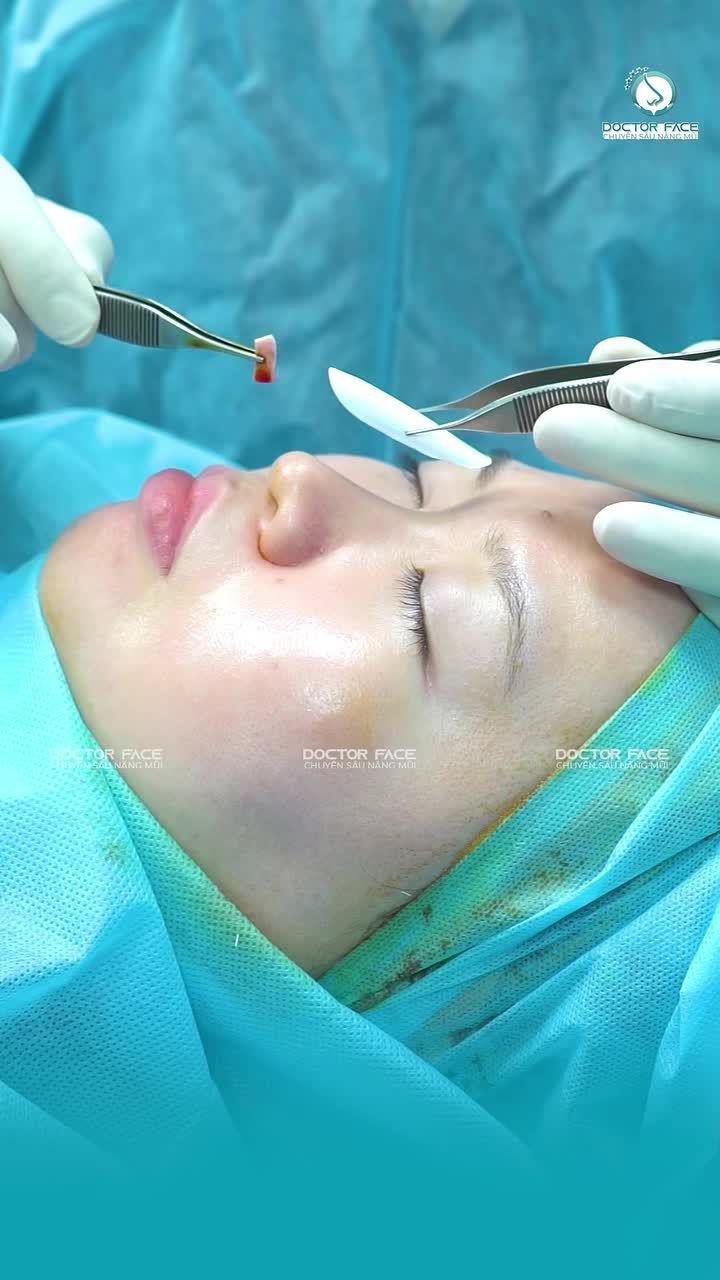 Khách hàng đã có lựa chọn của riêng mình. Vậy bác sĩ sẽ điều chỉnh và thiết kế dáng mũi như thế nào để phù hợp với gương mặt?