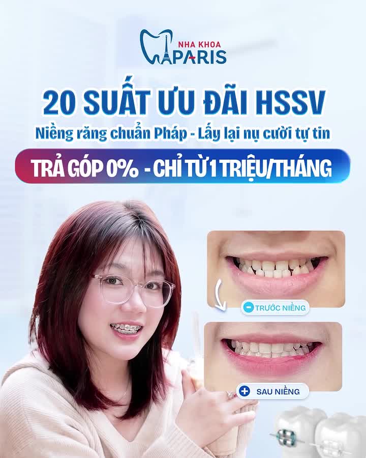 TRẢ GÓP 0% CHỈ TỪ 1 TRIỆU/THÁNG – TẠM BIỆT HÔ, MÓM, LỆCH LẠC