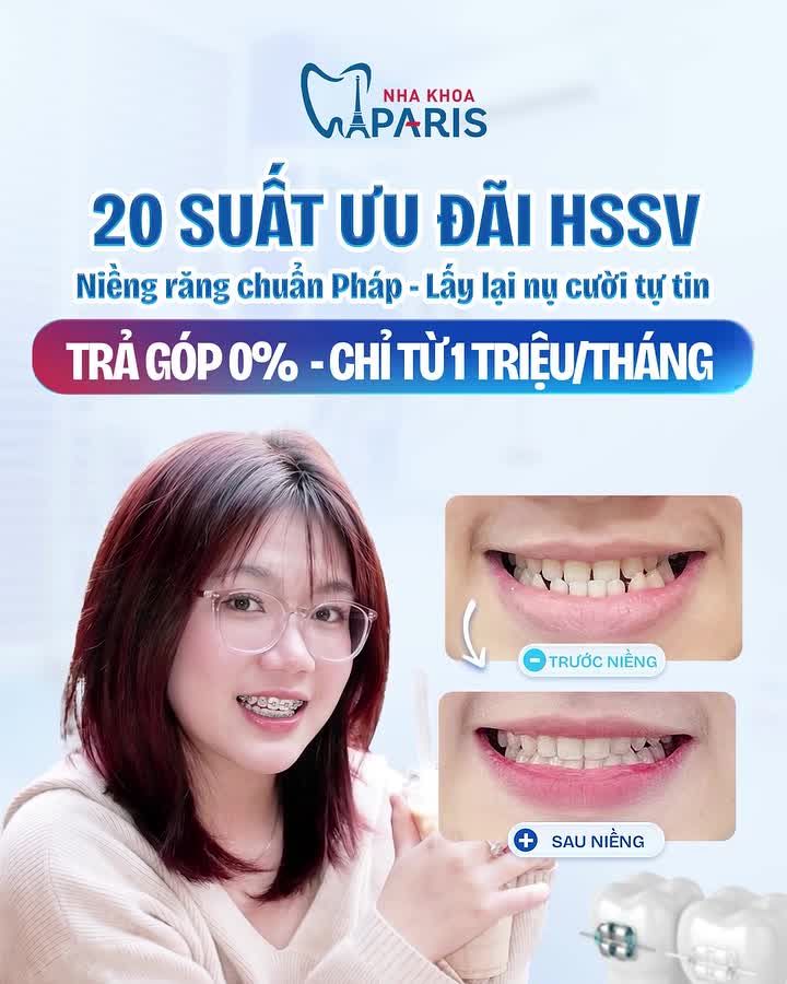 TRẢ GÓP 0% CHỈ TỪ 1 TRIỆU/THÁNG – TẠM BIỆT HÔ, MÓM, LỆCH LẠC