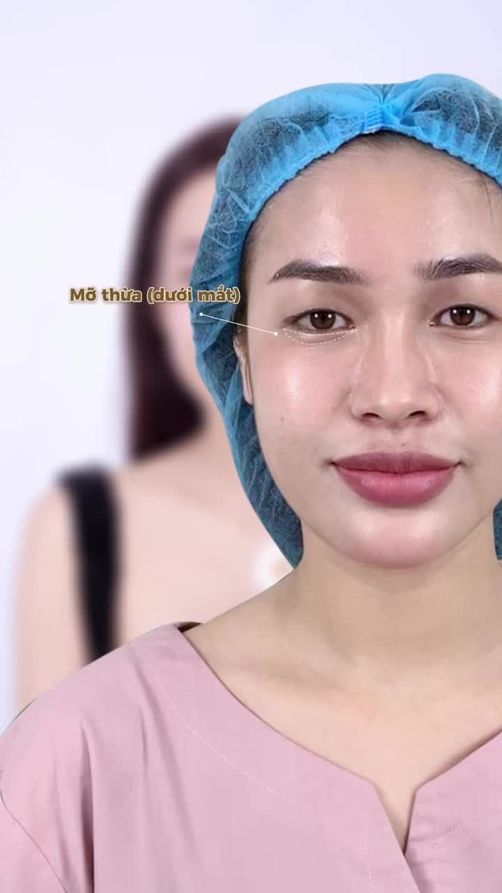 "Trộm vía không có tí sẹo nào hết" - Lời khen cho đôi mắt hiện tại của chị ấy chính là minh chứng rõ ràng nhất cho uy tín 15 năm của Tấm