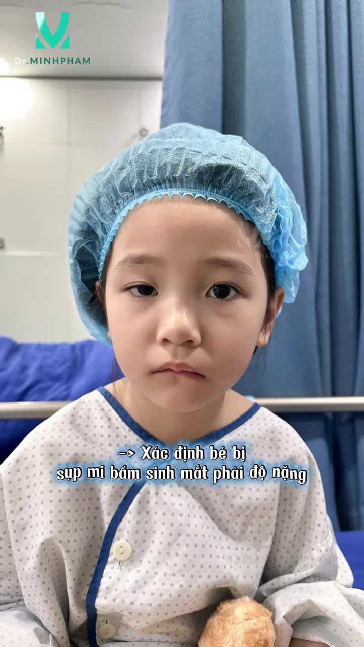 Đôi mắt đã hoàn toàn cân đối, hết sụp mi, tầm nhìn được giải phóng