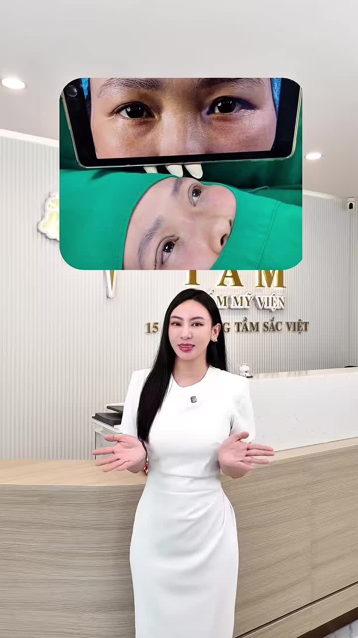 Chị HM đã "biến hình" cho đôi mắt mệt mỏi u buồn như thế nào?
