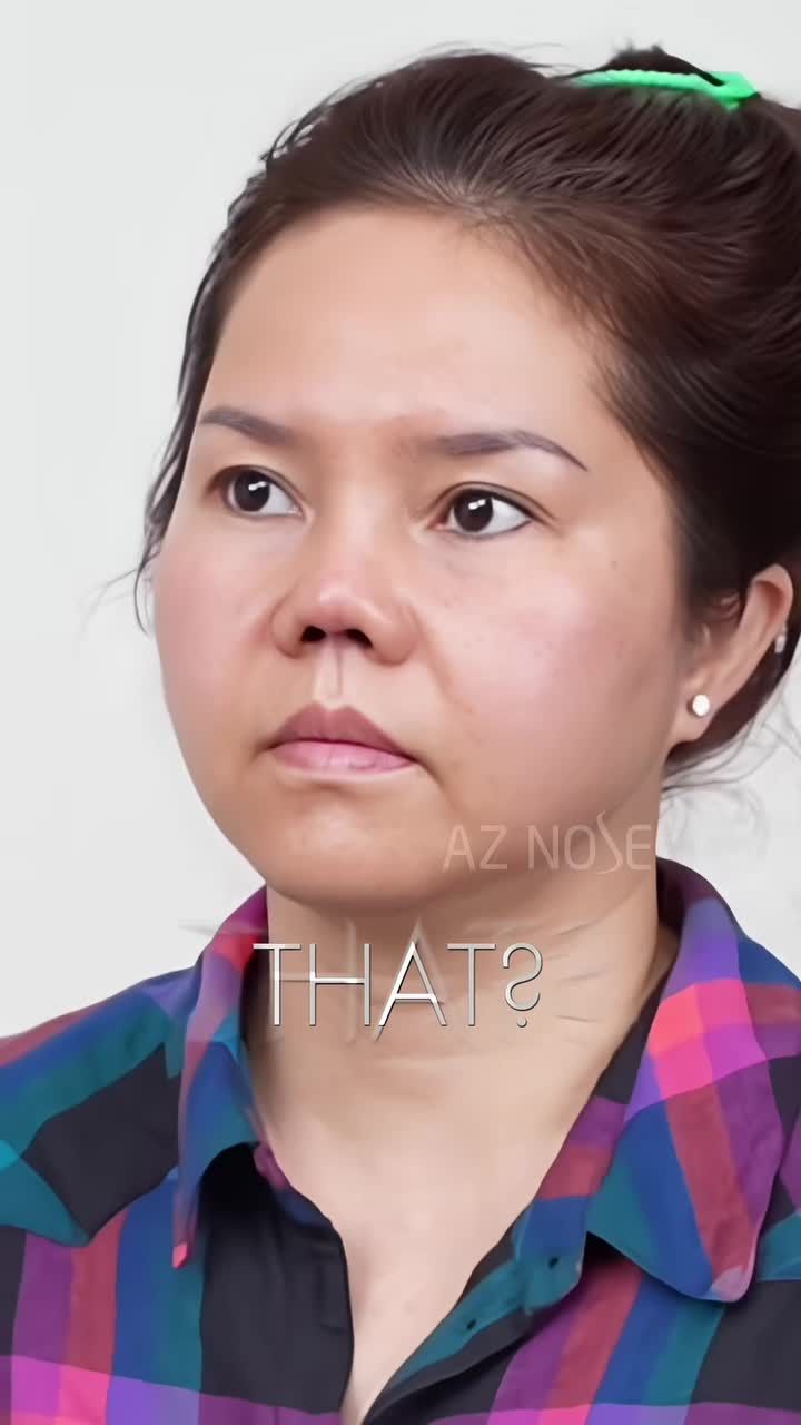 Hãy để AZNOSE đồng hành cùng bạn trong hành trình Tái tạo mũi hỏng.