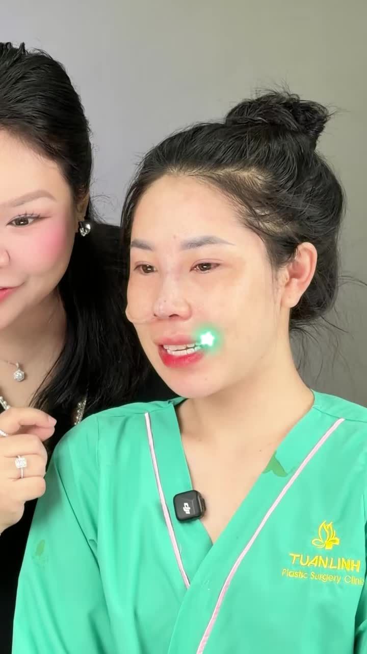 NÂNG MŨI – MỘT CHI TIẾT NHỎ, THAY ĐỔI CẢ TỔNG THỂ GƯƠNG MẶT