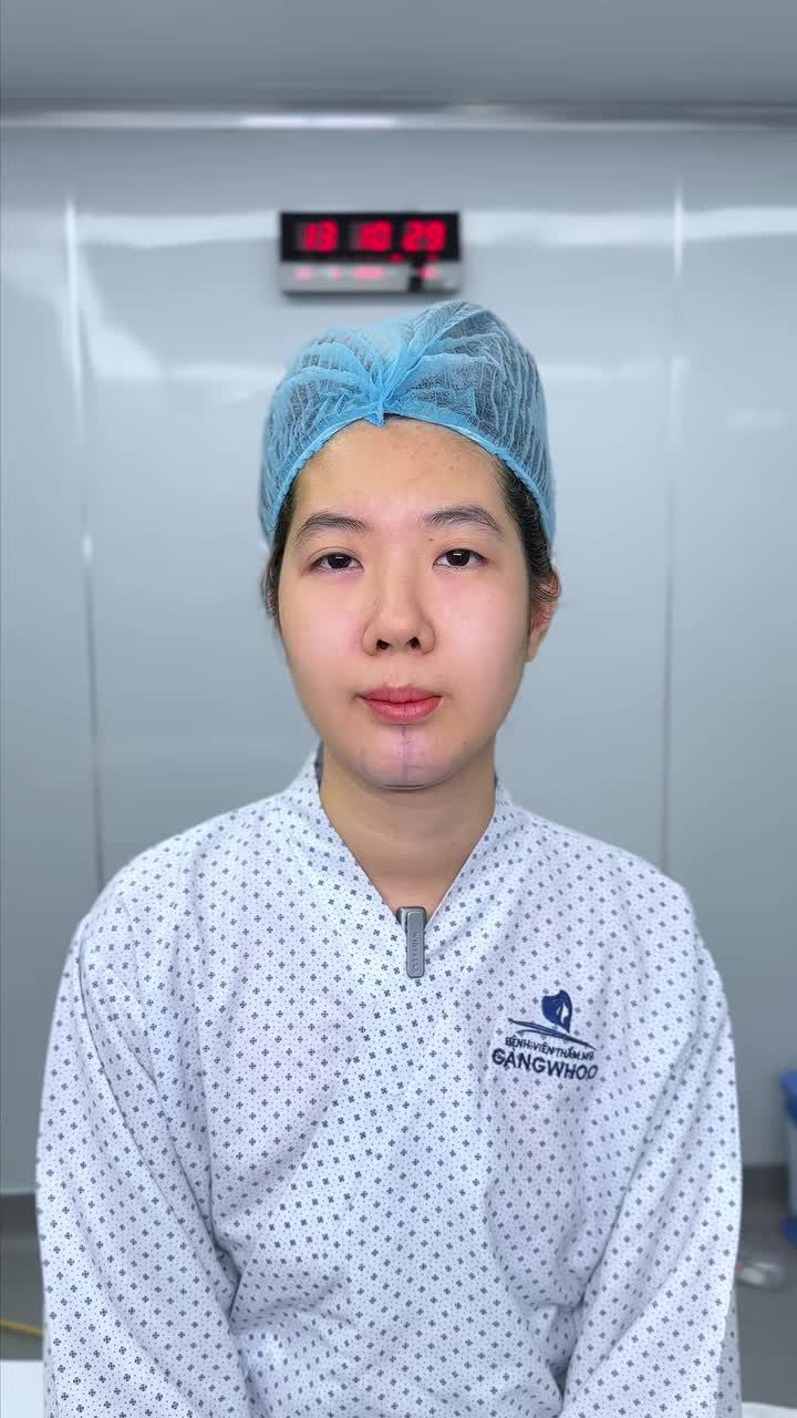 TẠI PHÒNG MỔ: KẾT QUẢ ĐỘN CẰM CỦA CÔ NÀNG LẬP TRÌNH VIÊN – ĐẸP VƯỢT XA SỰ TƯỞNG TƯỢNG!