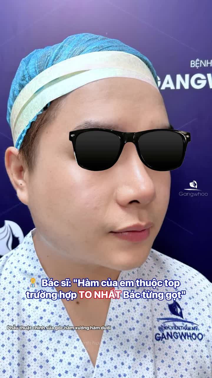 Bác sĩ : "Hàm của em thuộc top những trường hợp to nhất Bác từng gọt."