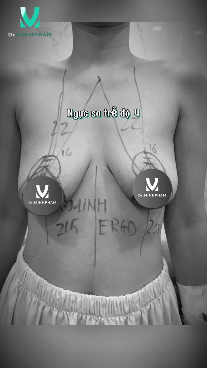 NGỰC SA TRỄ ĐỘ 4