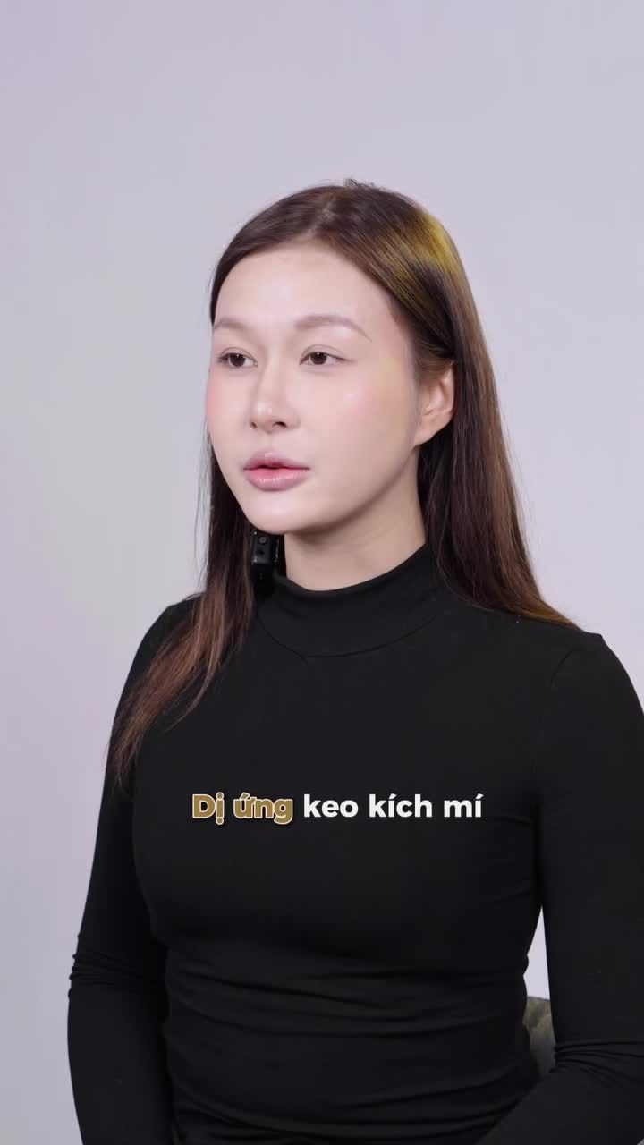 Chị khách “tạm biệt” keo kích mí, sở hữu mắt biếc tự nhiên nhờ cắt mí Shanghai nhà Tấm