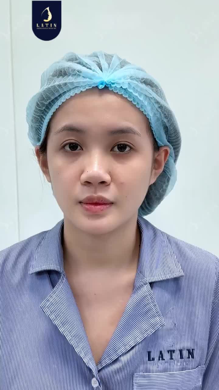 MŨI CAO CHUẨN DÁNG – MẶT XINH CHUẨN GU