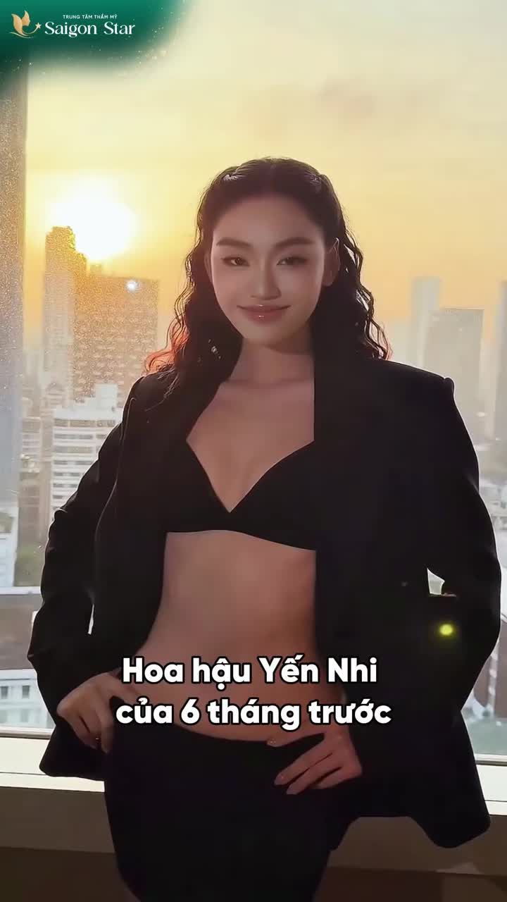 Sau 6 tháng thay dáng mũi và nâng cấp vòng 1, Hoa hậu Yến Nhi đã chính thức bước vào giai đoạn "đẹp quá đáng" khiến người đối diện khó tập trung khi trò chuyện.