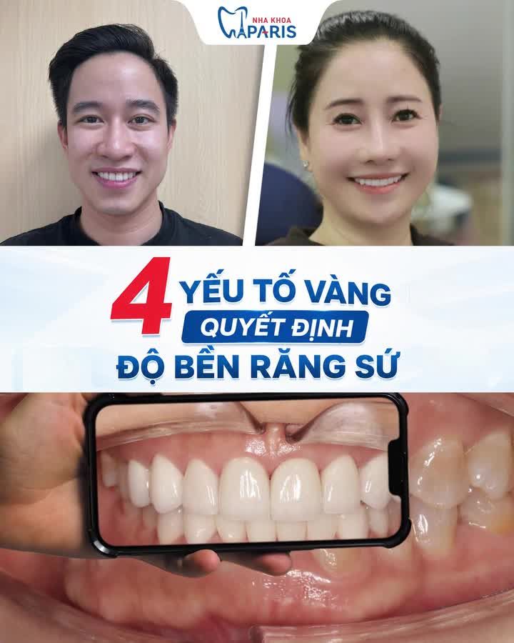 4 YẾU TỐ VÀNG QUYẾT ĐỊNH ĐỘ BỀN CỦA RĂNG SỨ!
