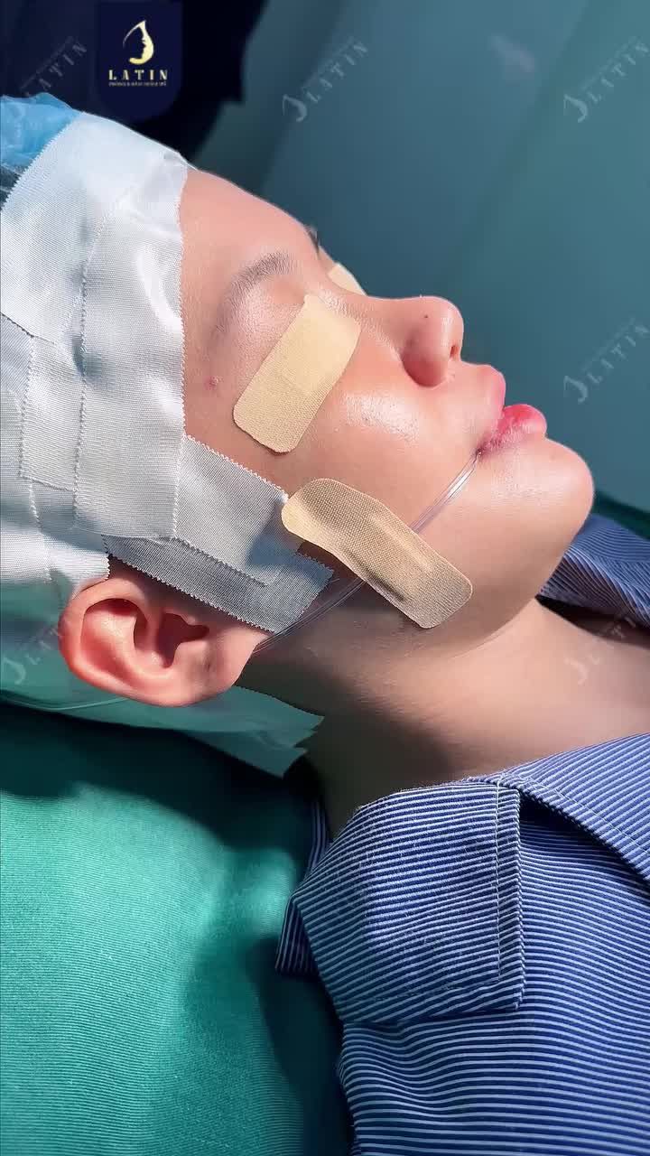 THAY ĐỔI DÁNG MŨI, THĂNG HẠNG NHAN SẮC.
