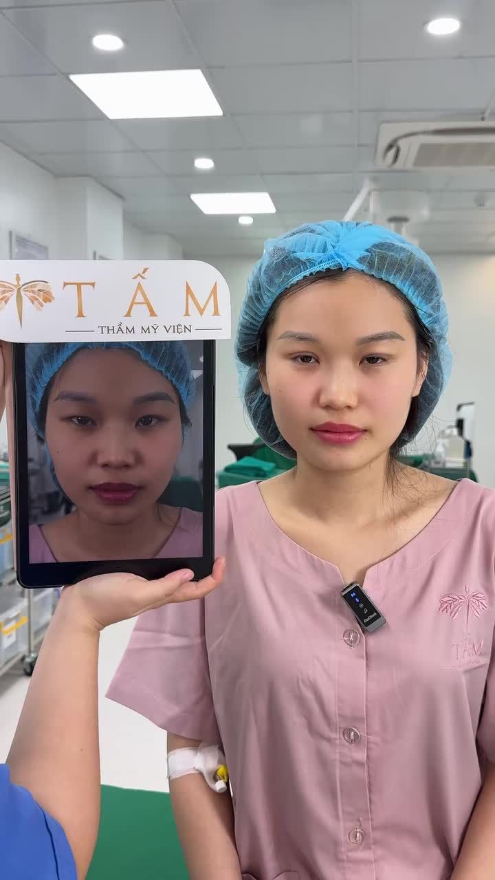 Từng "vật lộn" với kích mí mỗi lần trang điểm, giờ đây khách hàng đã sở hữu nếp mí rõ nét, tự nhiên và cân đối hơn sau khi Nhấn mí tại TMV Tấm.