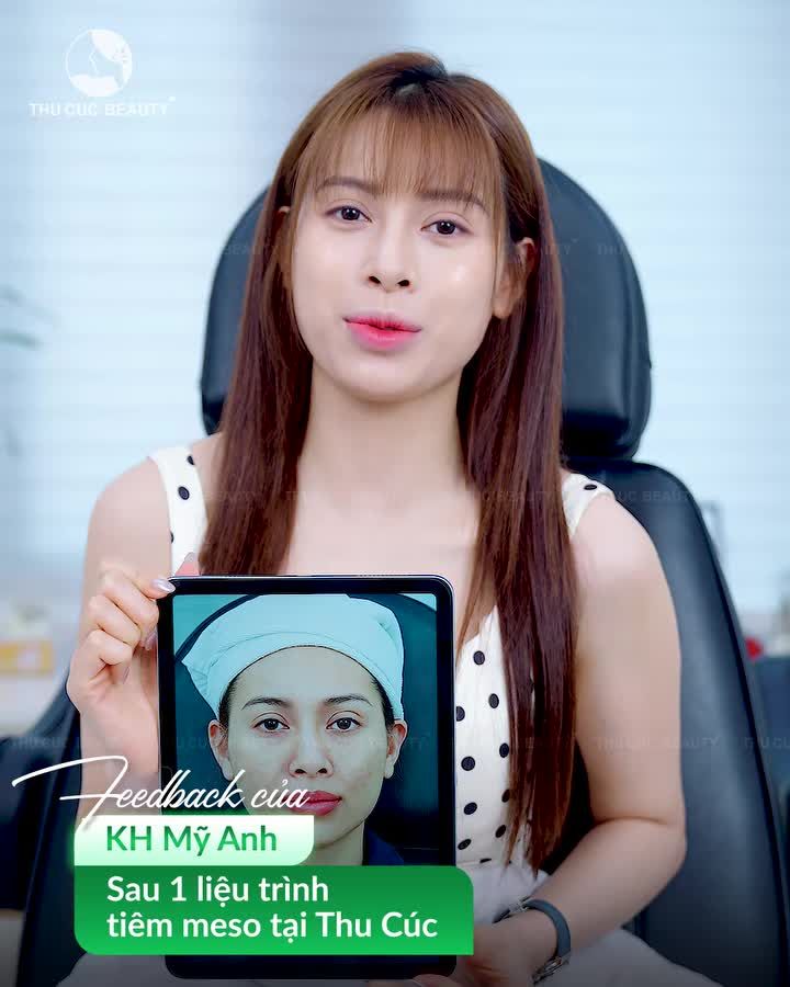 KHÁCH HÀNG MỸ ANH: "DA CĂNG BÓNG NHƯ GƯƠNG CHỈ SAU 1 LIỆU TRÌNH MESO"