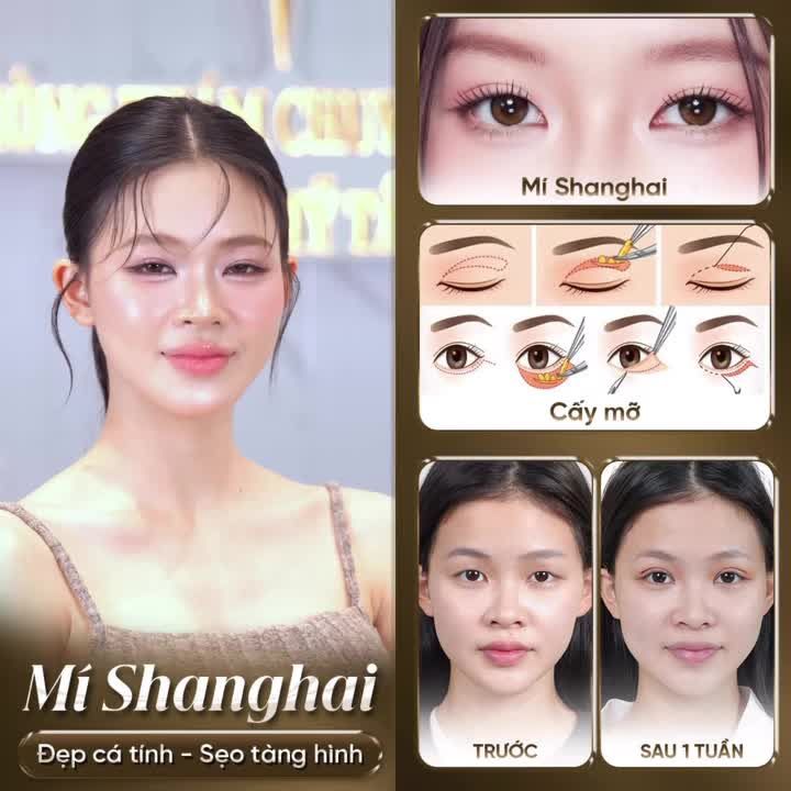 CẮT MÍ SHANGHAI - NÂNG TẦM NHAN SẮC