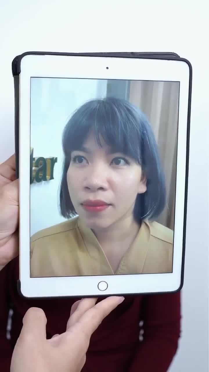 TỪ HÀN QUỐC VỀ VIỆT NAM NÂNG MŨI - CHỊ KHÁCH NHẬN ĐƯỢC KẾT QUẢ VIÊN MÃN