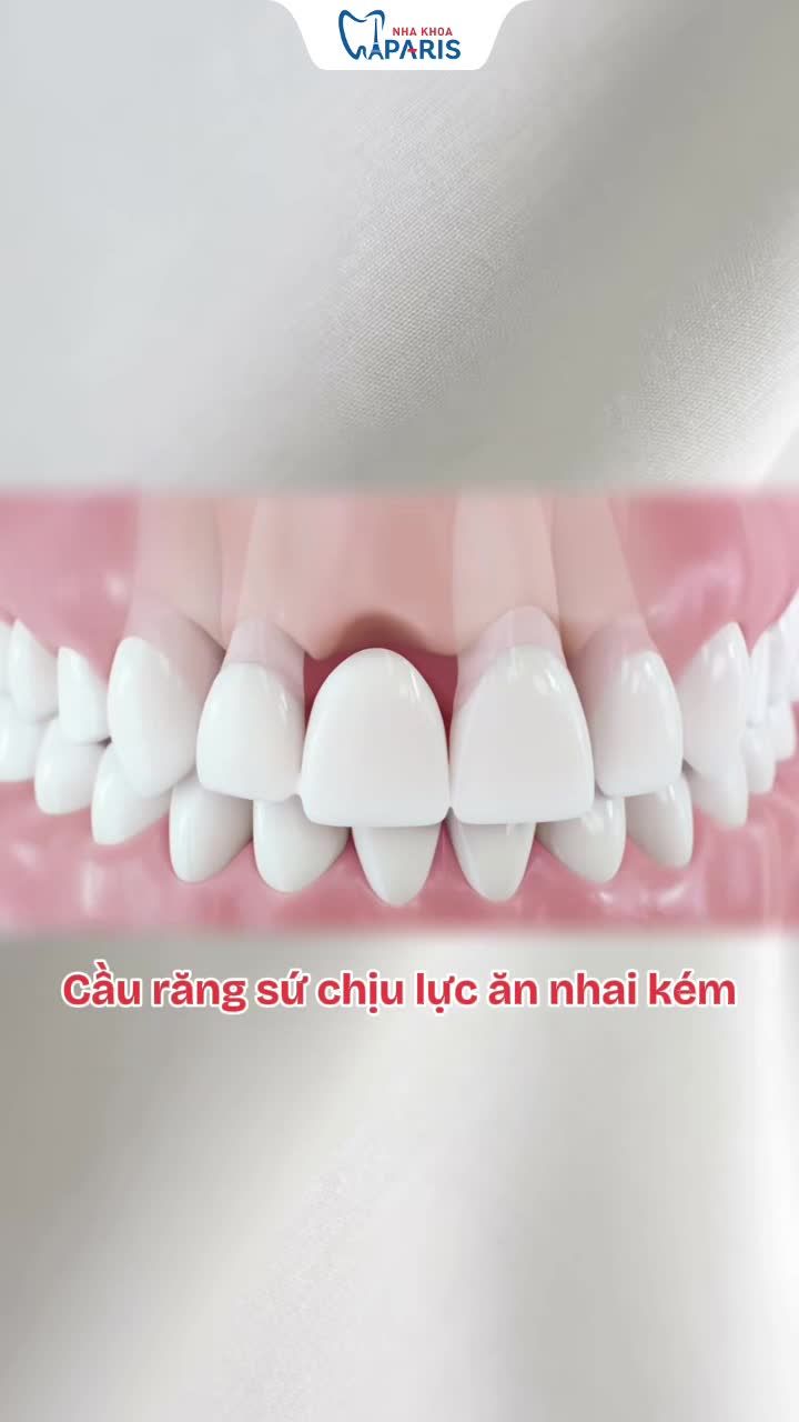 TRỒNG RĂNG IMPLANT – GIẢI PHÁP PHỤC HỒI RĂNG MẤT BỀN CHẮC HÀNG ĐẦU HIỆN NAY
