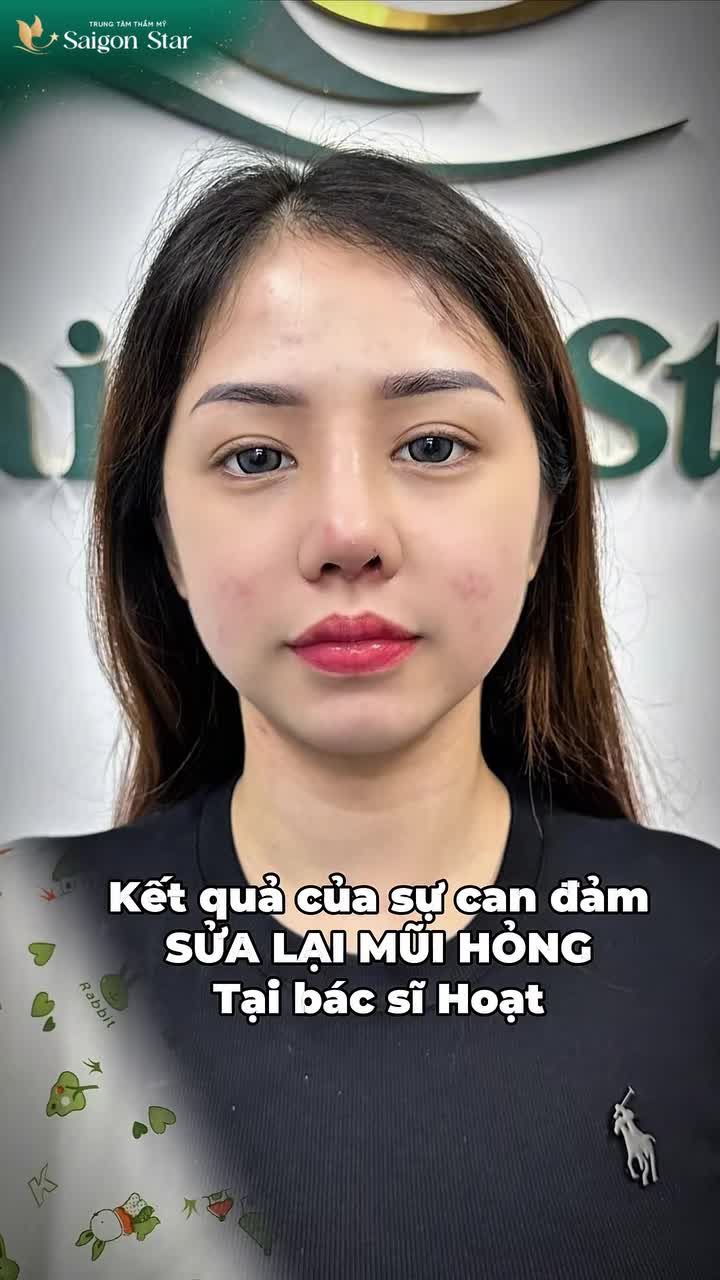 CAN ĐẢM SỬA LẠI MŨI HỎNG CHÀO ĐÓN PHIÊN BẢN TỰ TIN CỦA CHÍNH MÌNH!!