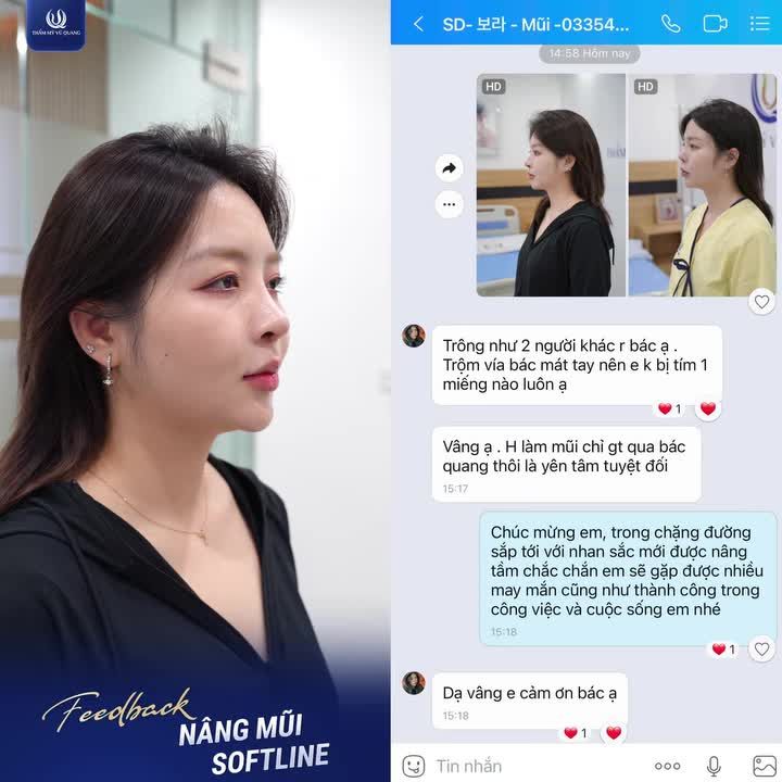 Một chiếc inbox khiến cả Ekip Thẩm mỹ Vũ Quang ấm lòng