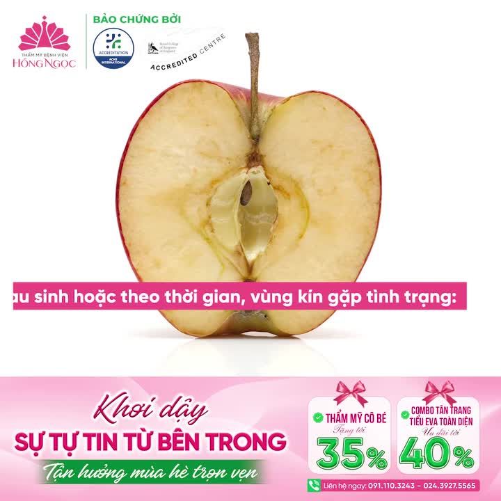 TỰ TIN TRỌN VẸN - NÂNG NIU VẺ ĐẸP THẦM KÍN CỦA CHỊ EM PHỤ NỮ