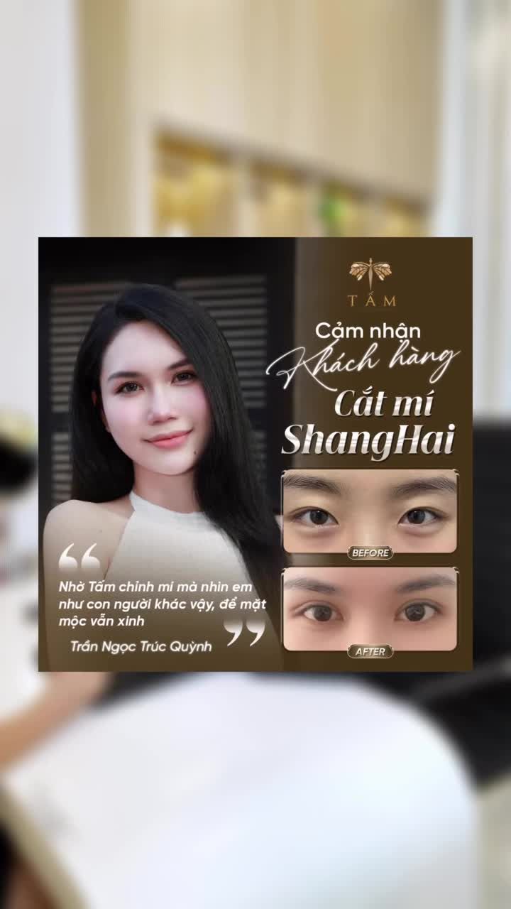 Khi hội bạn thân tìm được "gu" mí mắt chân ái: Tự nhiên, hài hòa và cuốn hút!